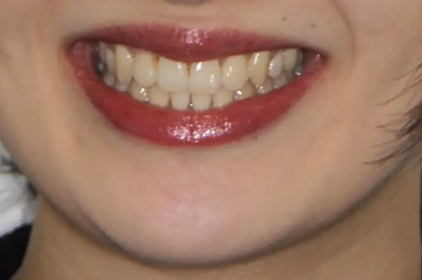 After