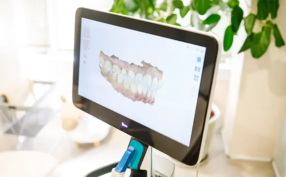当院のマウスピース型矯正装置(インビザライン)の特長