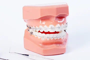 唇側矯正